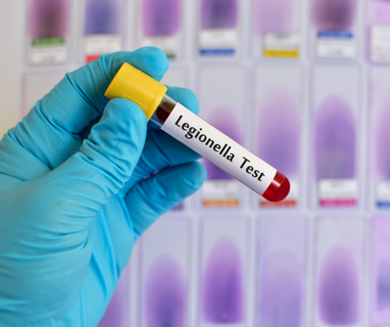 Legionelloza – co to jest za choroba i jak się przed nią chronić?