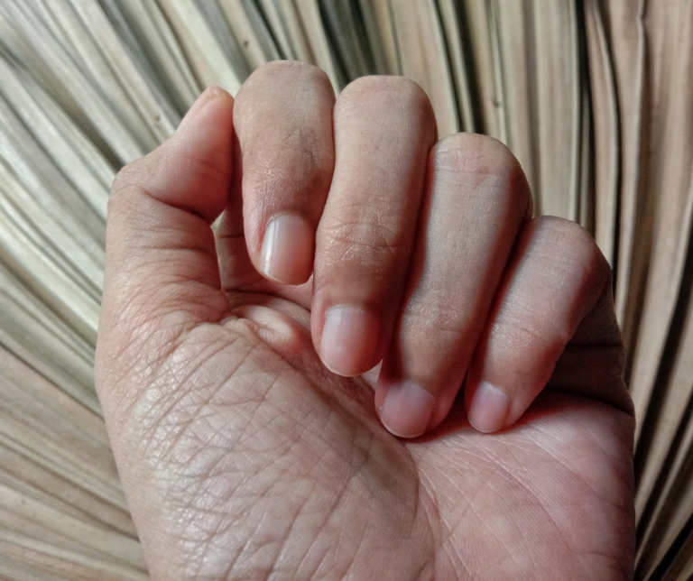 Pokaż mi swoje paznokcie, a powiem ci na co chorujesz