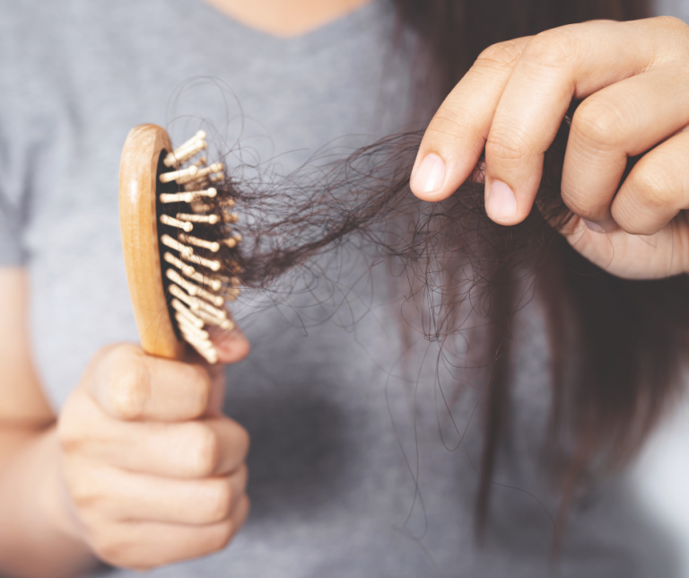 Wypadanie włosów – przyczyny, objawy i sposoby leczenia