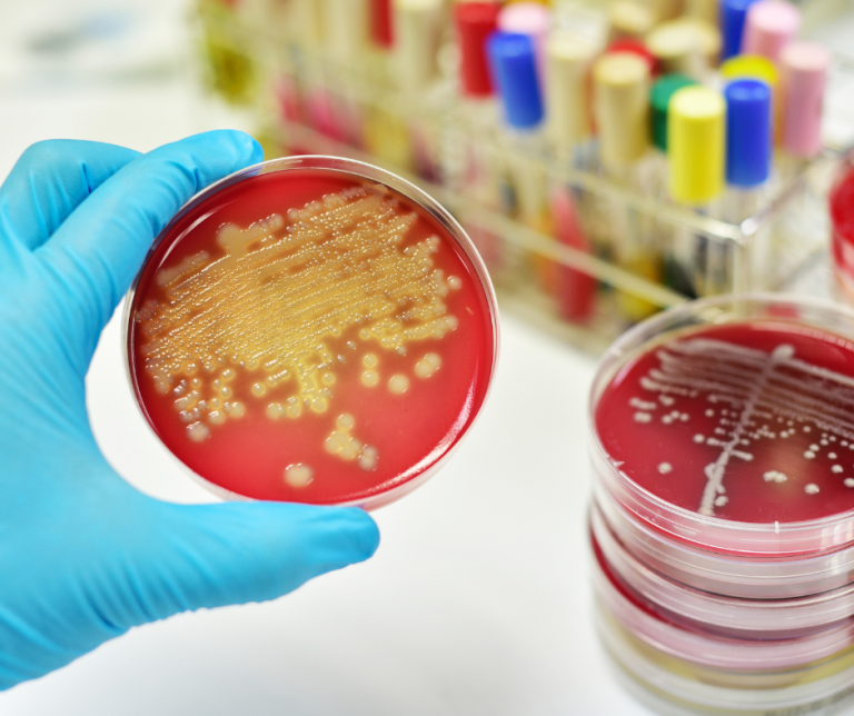 Sepsa – groźna reakcja na zakażenie